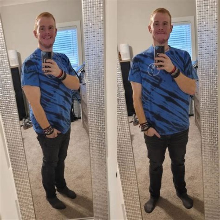 
Casey King’s Amazing Weight Loss Journey From 845 lbs to 266 Lbs! 