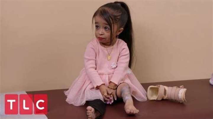 Did Jyoti Amge Have Surgery On Her Legs? “Dont Treat Me Like A Baby” AHS episode On World’s Smallest Woman