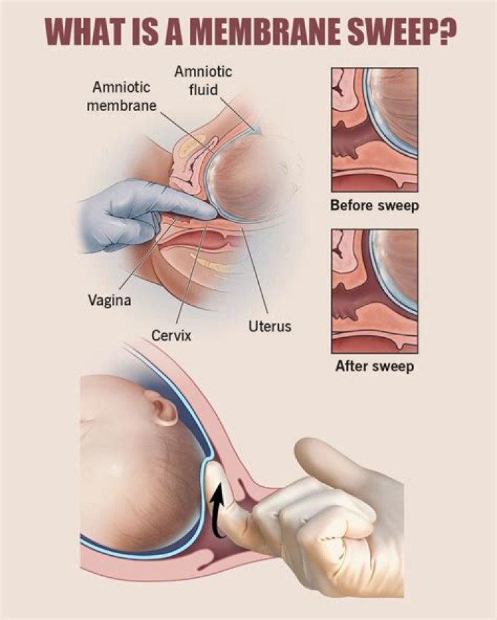 Difference between cramps and contractions after membrane sweep