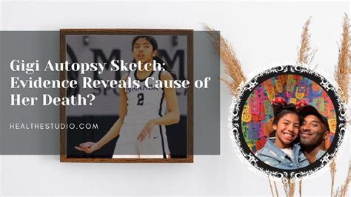 Gigi Bryant Autopsy Sketch Reddit, This Is Why Kobe Crash Photos Lawsuit Is Important