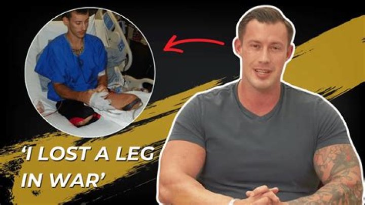 How Did Joey Jones Lose His Legs?