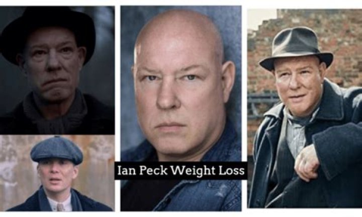 Ian Peck Weight Loss Explained What Happened To The Actor Who Plays Curly In Peaky Blinders?
