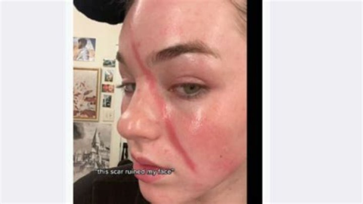 Jentri Wallace’s Scar: What Happened to Her Face? Was It an Accident?