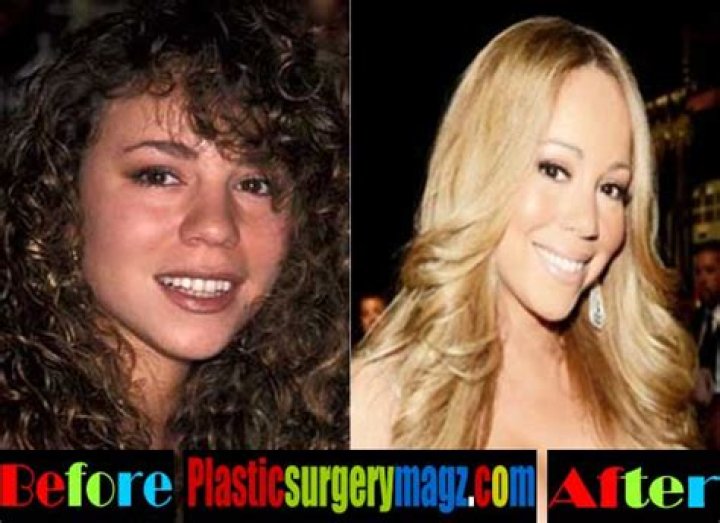 Mariah Carey Nose Job | Before And After Photos