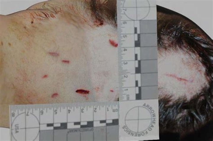 RIP: Ellen Greenberg Death Scene -Was It A Suicide Or Homicide? Details To Know