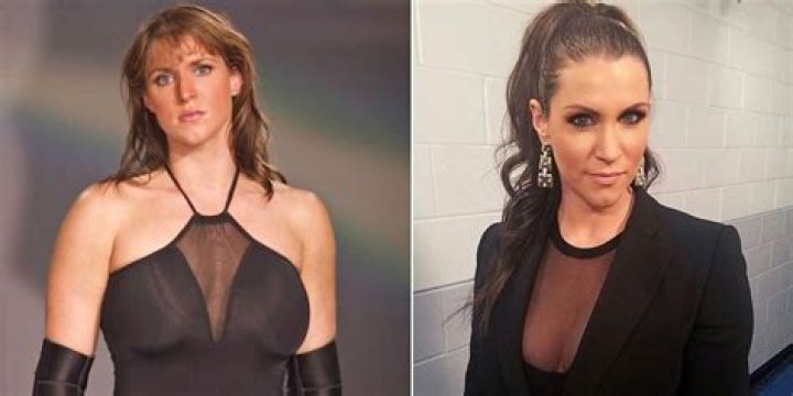 Stephanie McMahon Plastic Surgery – Before And After Pictures