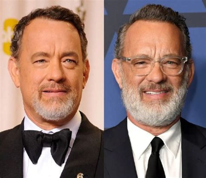 Tom Hanks Nose Job Rumor | Did He Undergo Surgery