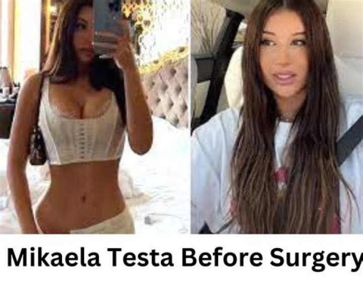 Who Is Simpforatispaul TikTok? Mikaela Testa Before Surgery Photos On Instagram